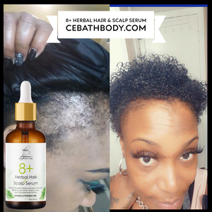 8+ Hair & Scalp Serum 2oz - 3 Month Supply